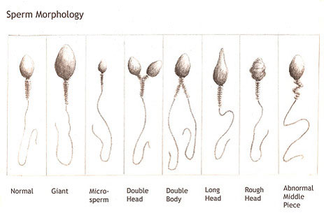 Semen Analysis
