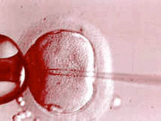 Nonsurgical Vasectomy Reversal